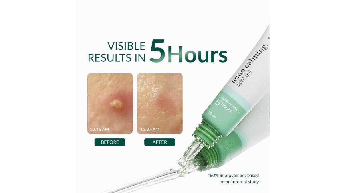 Bio Beauty Lab Acne Spot Gel