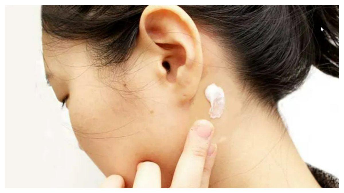 Cara melakukan patch terst produk skincare