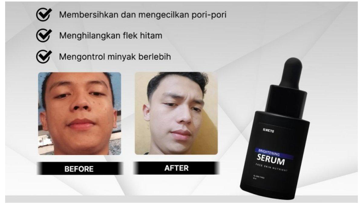 Elvicto Brightening Serum