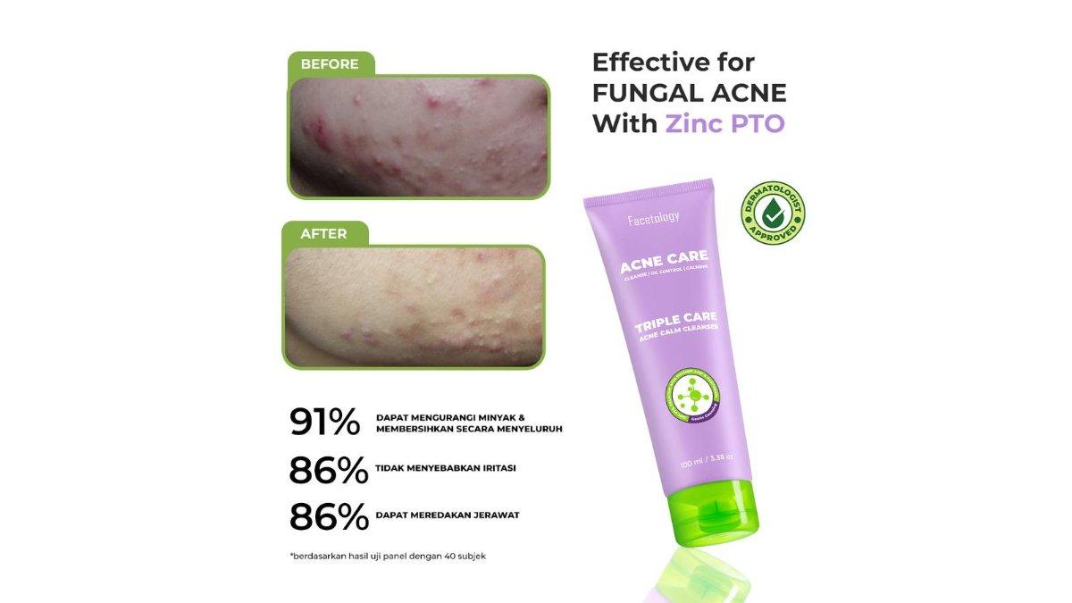 Facetology Triple Care Acne Calm Cleanser