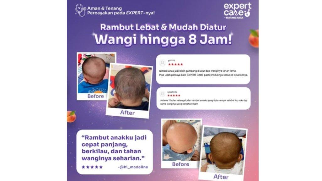 Hair Lotion Anak & Bayi - Expert Care Hair Nutrilotion 100ml