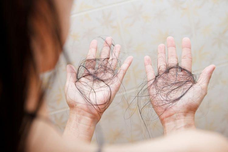 Hair tonic for hair loss