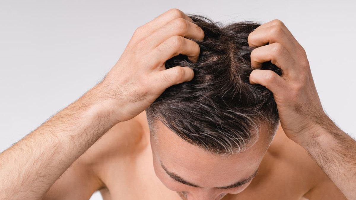 Hair tonic untuk menutrisi kulit
