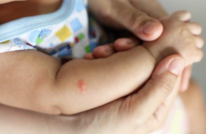 Ilustrasi Penyebab Gigitan Serangga pada Bayi
