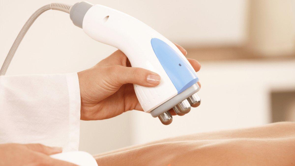 Ilustrasi Radiofrequency Therapy untuk menghilangkan stretch mark