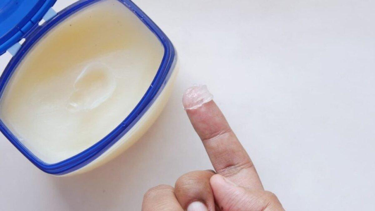 Ilustrasi petroleum jelly yang dapat mengatasi masalah kulit mengelupas dan kering.