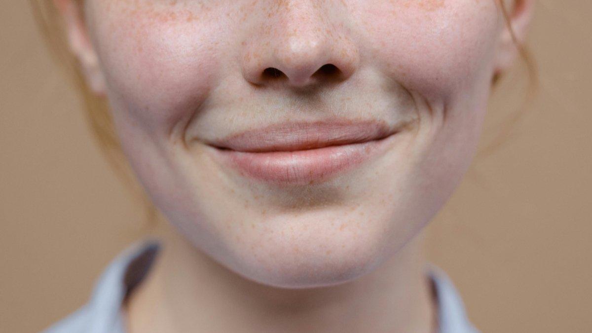 Madu bisa kamu manfaatkan untuk melembutkan tekstur bibir.