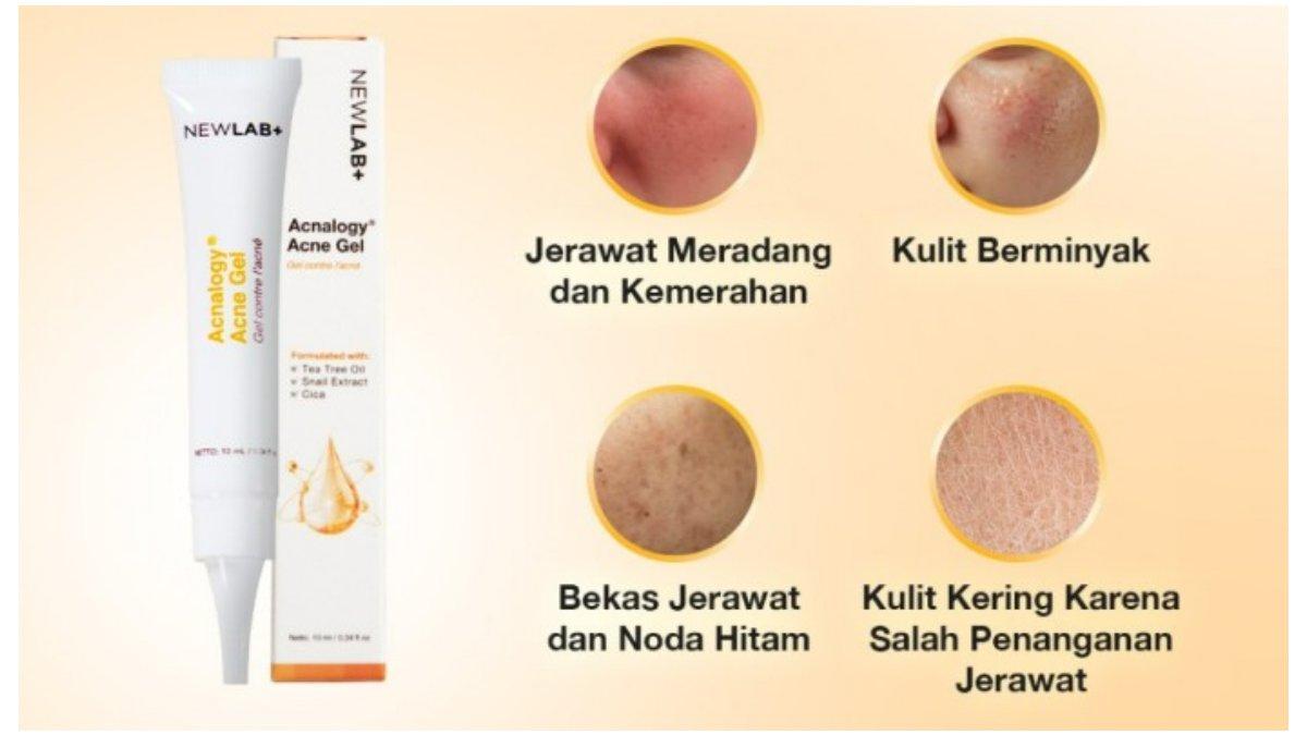 NEWLAB Acnalogy Acne Gel