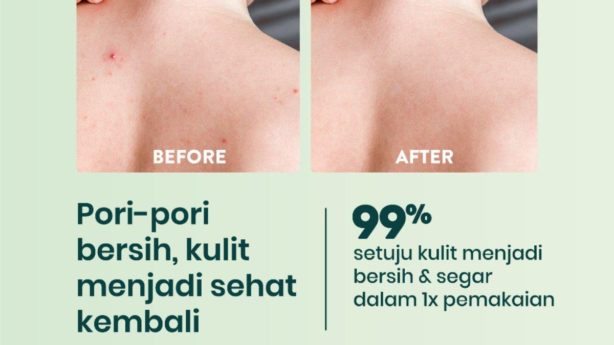 NPURE Acne Clear Cica Body Wash