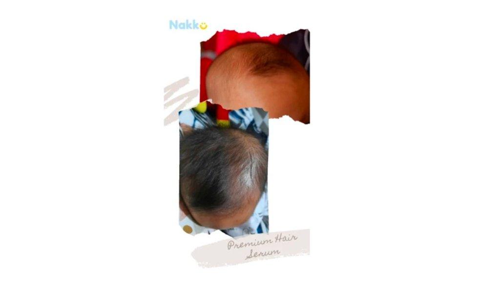 Nakku Premium Hair Serum