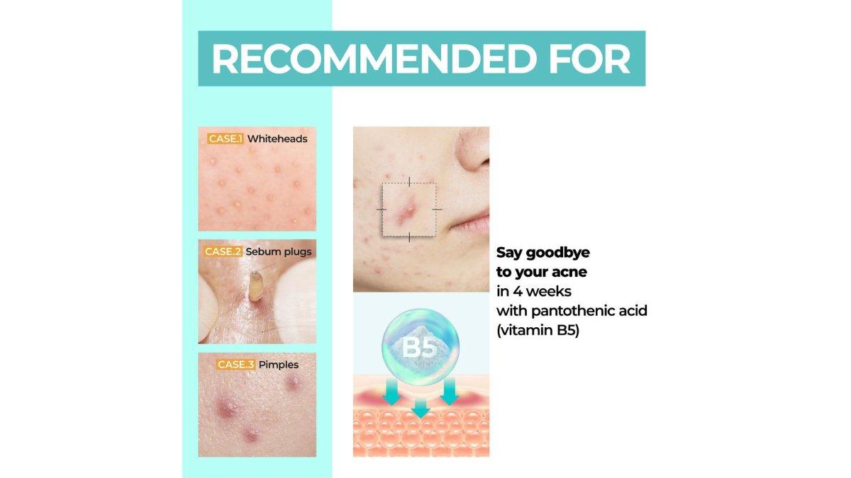 Numbuzin No 1 Pantothenic B5 Active Soothing Cream