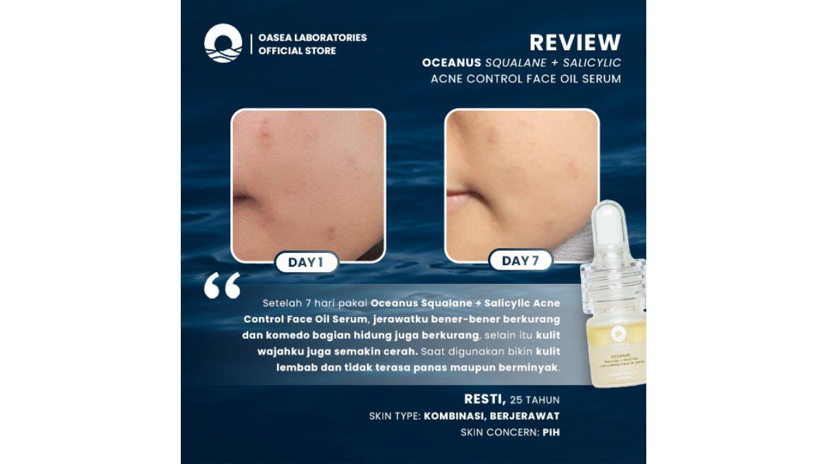 Oasea Salicylic Acne Control Face Oil Serum
