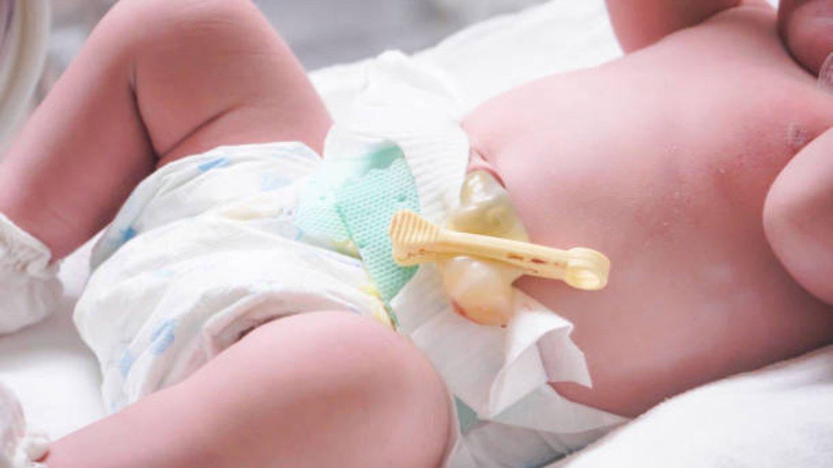 Kenali Tanda-Tanda Infeksi dari Pusar Bayi dan Kapan Harus ke Dokter.