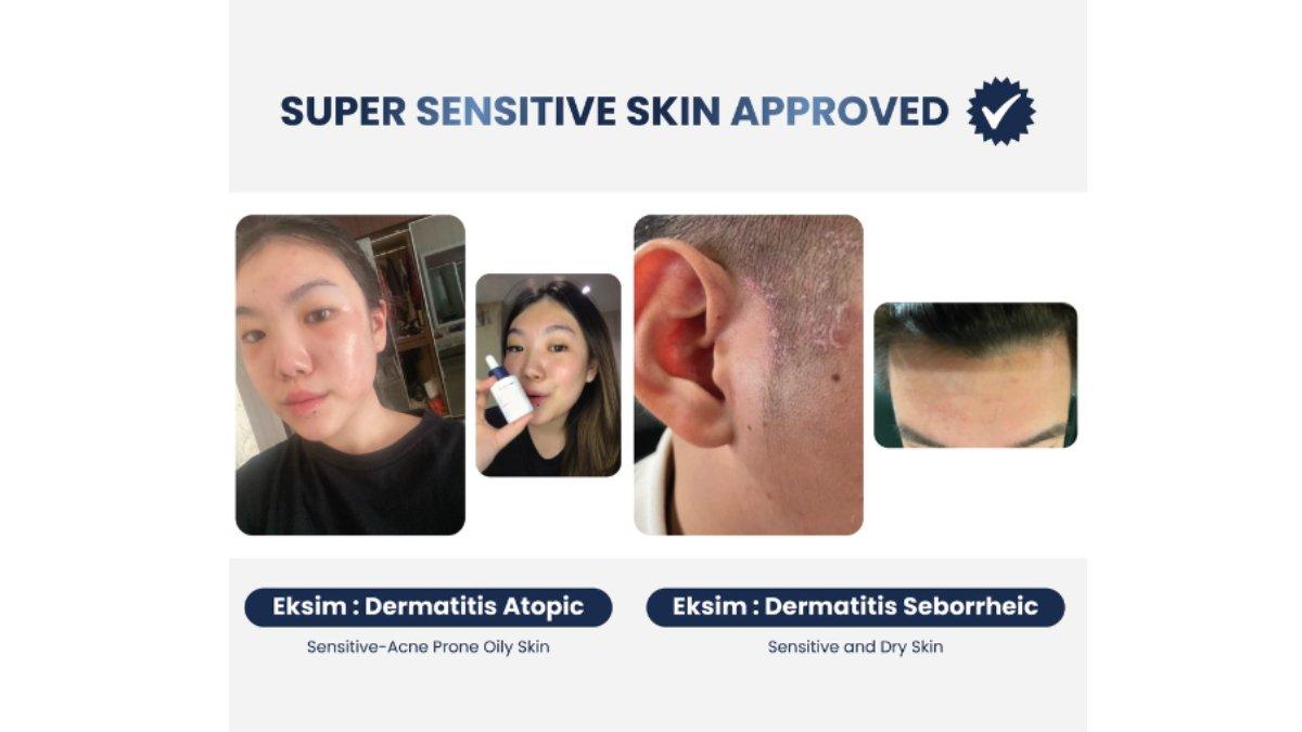 SKIN TIME Probiotic Brightening Serum