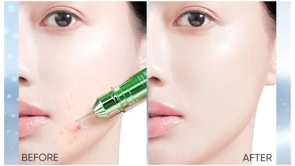 SKINTIFlC 3X Acid Intensive Acne Spot Gel