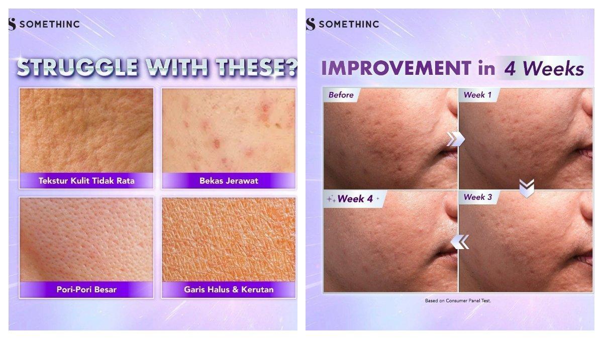 SOMETHINC BioSpicule Renewal Serum