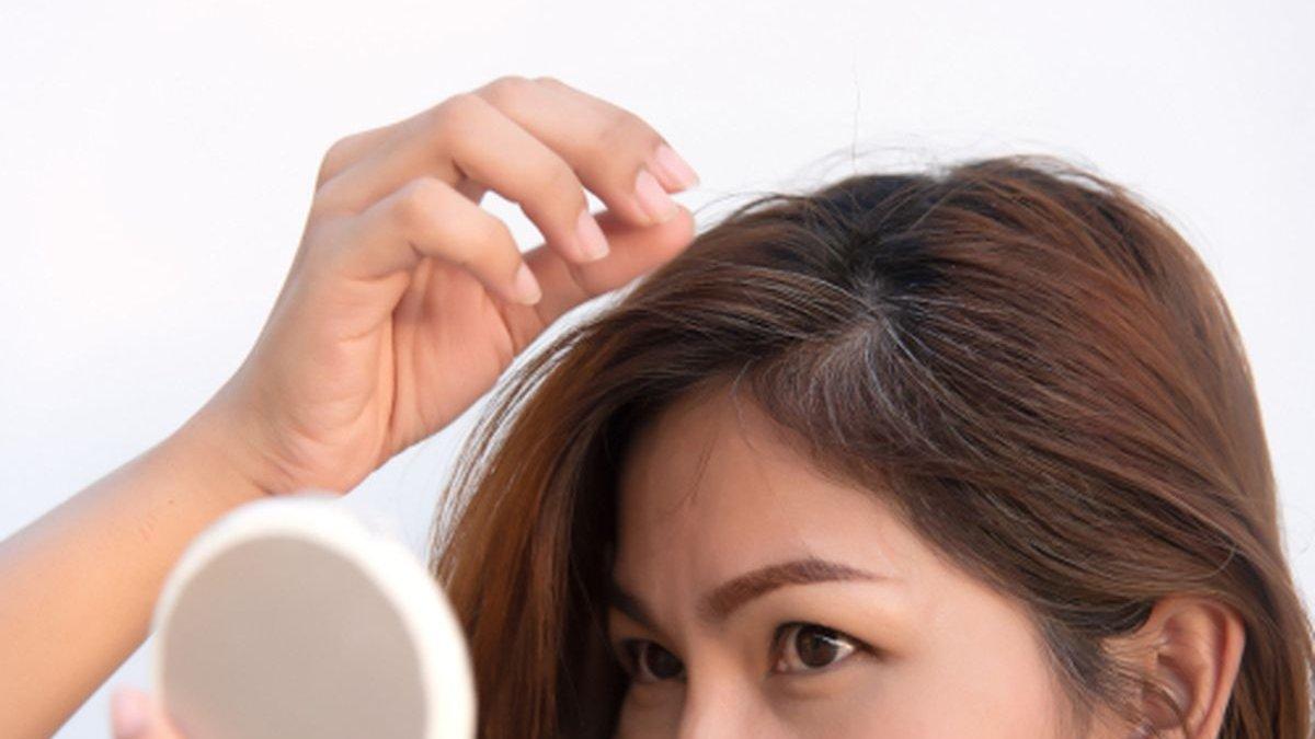 Uban yang muncul di rambut kepala