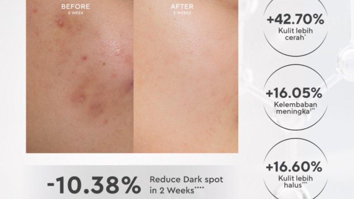 Wardah Tranexamic Acid + Alpha Arbutin Crystal Secret Dark Spot Brightening Serum