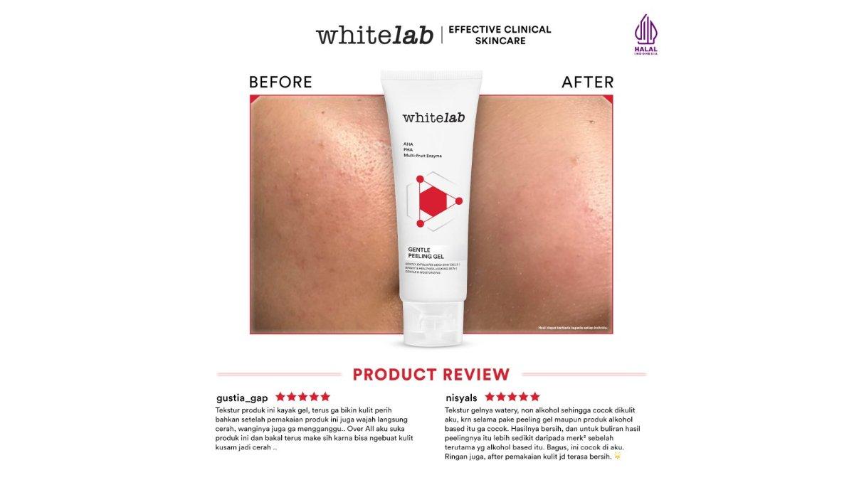 Whitelab Gentle Peeling Gel