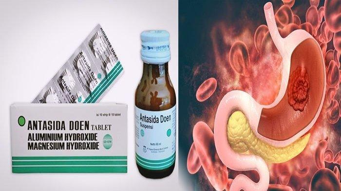Ilustrasi obat antasida yang boleh tersedia di rumah.