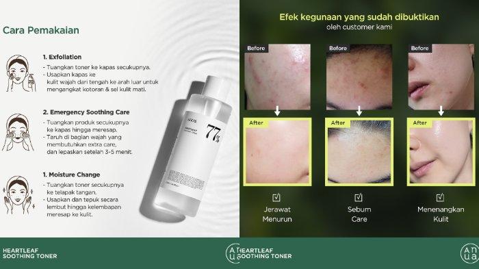 ANUA Heartleaf Soothing Toner