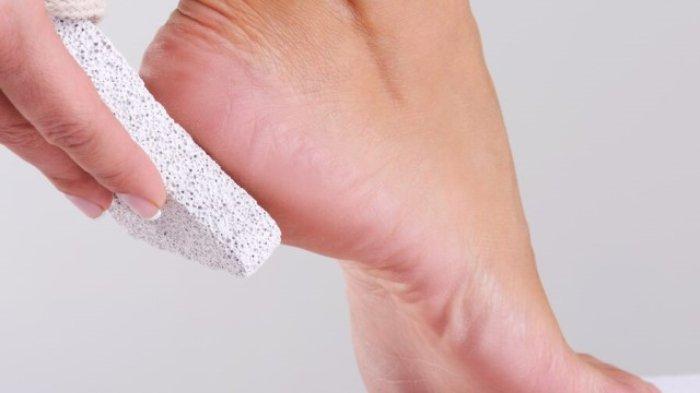 Batu apung yang dicampurkan dengan getah pepaya bisa membantu mengatasi kaki yang pecah-pecah.