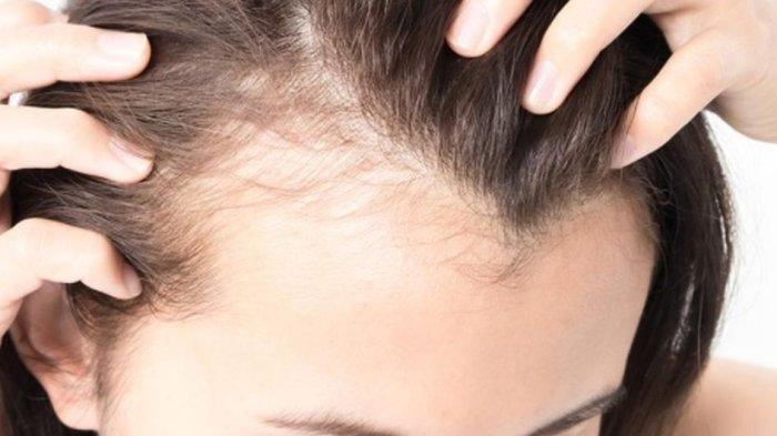 Perawatan dengan jahe bisa merangsang pertumbuhan rambut.