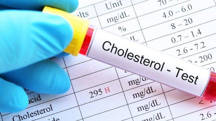 Hasil test kolesterol yang ternyata tinggi di atas kadar normal.