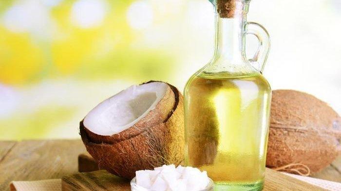 Ilustrasi minyak kelapa.