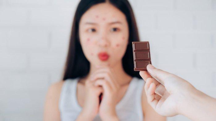 Ilustrasi kulit wajah yang berjerawat.