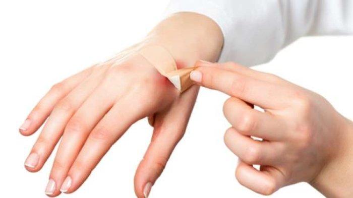 Daun katuk juga dapat mendukung Proses Penyembuhan Luka