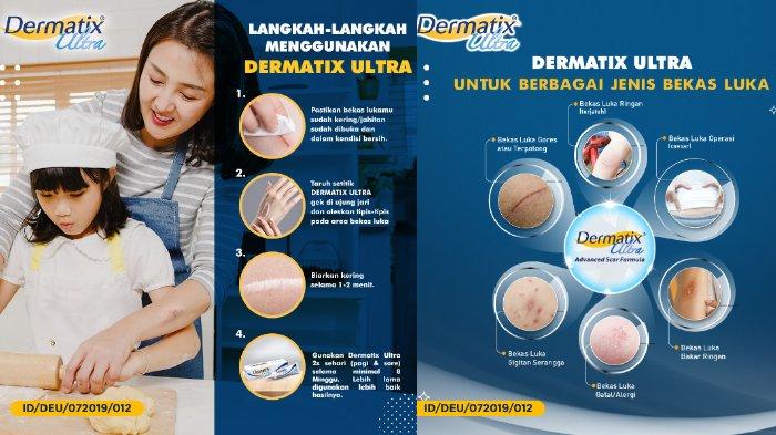 Dermatix Ultra 5 gram.