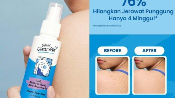 Dermies Clear Me Pimple Body Mist 