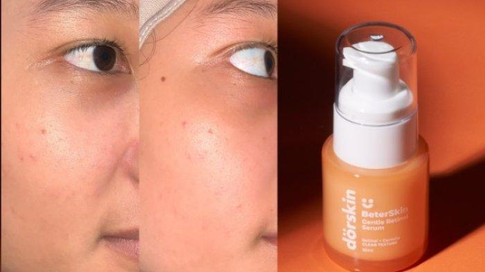 Dorskin BeterSkin Gentle Retinol Serum