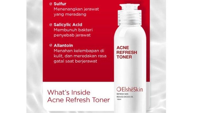  ElsheSkin Acne Refresh Toner