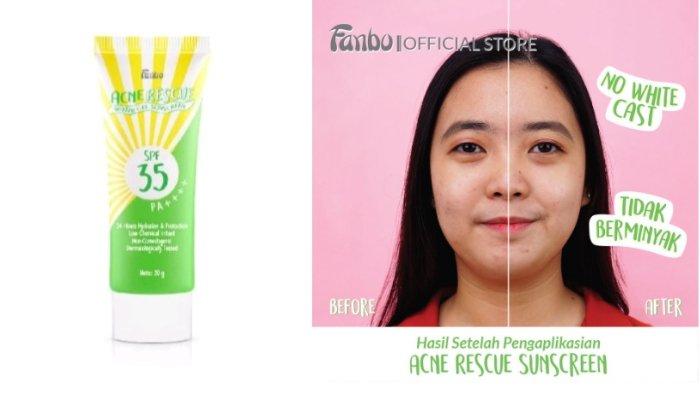 Fanbo Acne Rescue Water Gel Sunscreen SPF 35