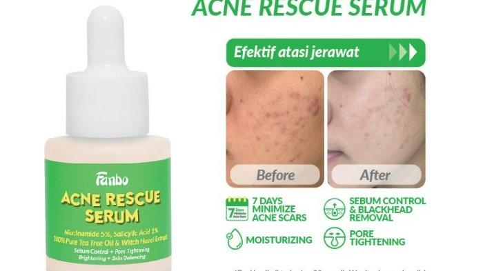 Fanbo Skin Goals Acne Rescue Serum