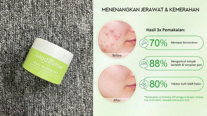 Glad2Glow Real Mugwort Salicylic Acid Acne Control Clay Mask