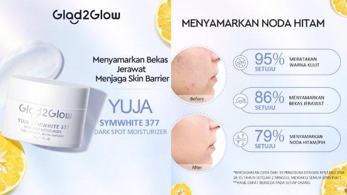 Glad2Glow Yuja Symwhite 377 Dark Spot Moisturizer