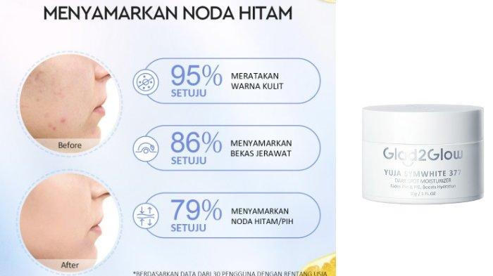 Glad2Glow Yuja Symwhite 377 Dark Spot Moisturizer