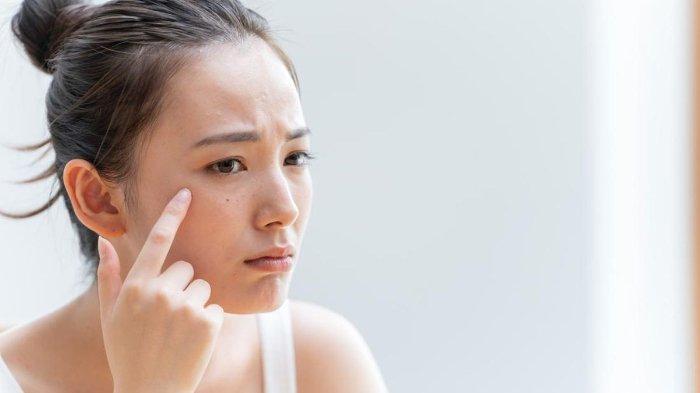 Ilustrasi kulit wajah rentan bermasalah karena skin barrier yang tidak terjaga.