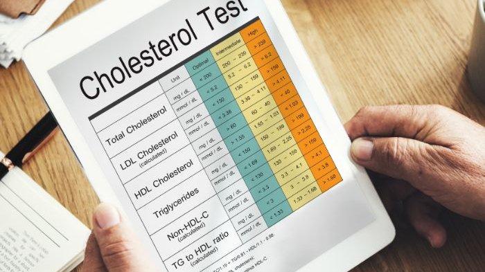 hasil pemeriksaan dengan hasil kadar kolesterol tinggi.