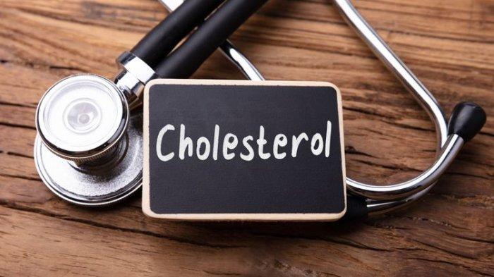 Hasil test kolesterol yang ternyata tinggi di atas kadar normal.