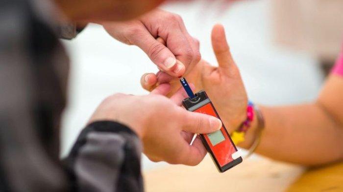 Ilustrasi cek kadar kolesterol.