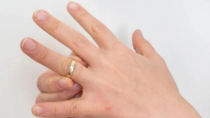 Ilustrasi cincin sulit dilepas.