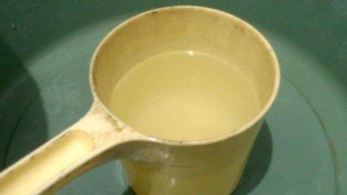 Gayung yang kotor dan penuh kerak harus dibersihkan secara rutin supaya tidak menjadi sarang kuman dan bakteri.