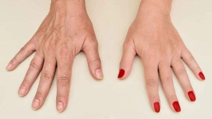 Teknik manicure atau perawatan kuku yang kurang tepat juga merupakan salah satu penyebab kulit tangan menjadi keriput.