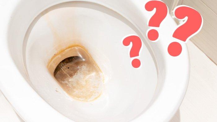 Kondisi air pada mangkuk kloset bisa menjadi pertanda apakah septic tank sudah penuh atau belum.
