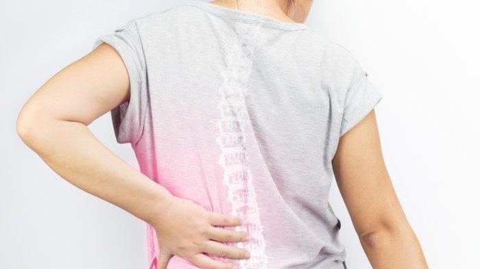 Ilustrasi wanita mengalami penyakit osteoporosis.