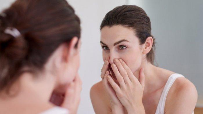 Ilustrasi perempuan yang memegang wajah, jika terlalu sering dilakukan bisa menyebabkan komedo.